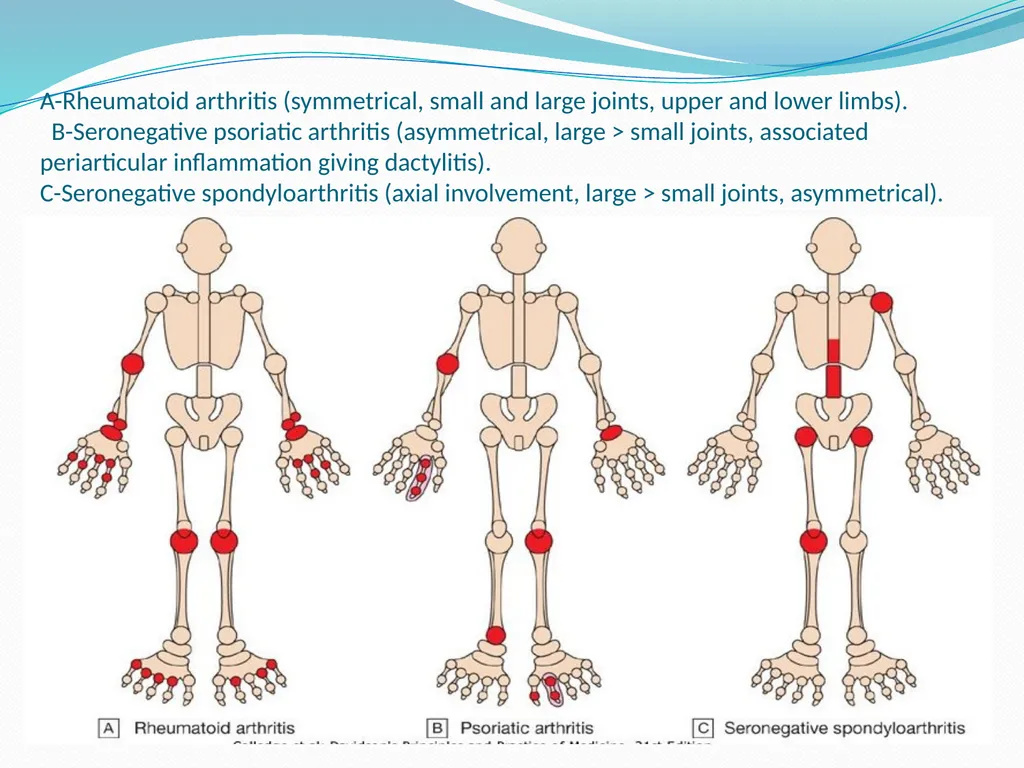 STRUCTURE AND FUNCTION OF BONE, JOINTS AND - slide 7 of 26