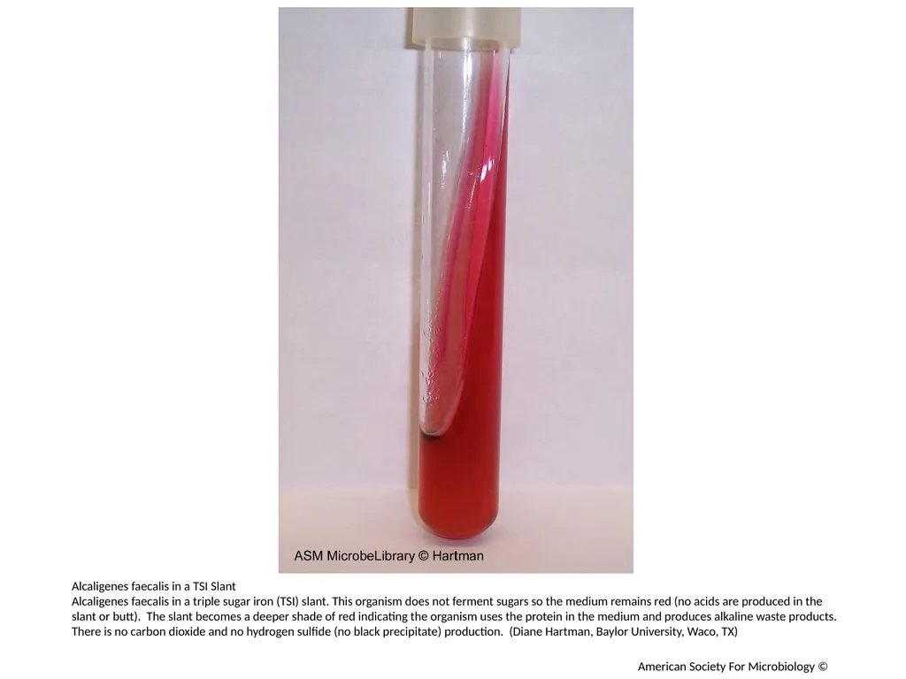 Fermentation Author: Multiple Authors Citation: - slide 11 of 21