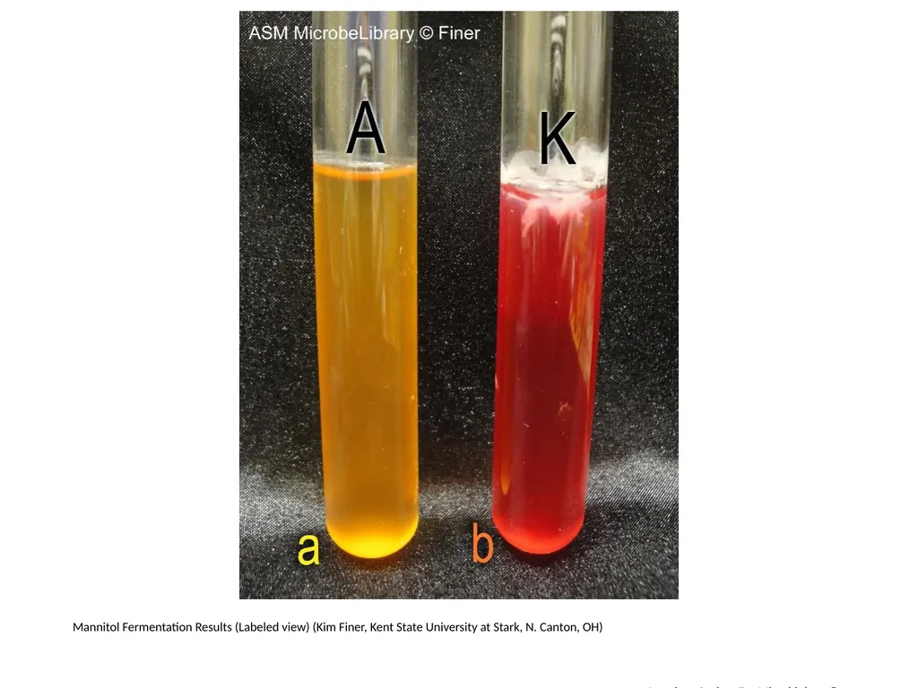 Fermentation Author: Multiple Authors Citation: - slide 8 of 21