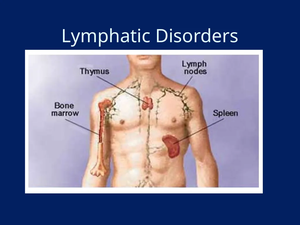 Lymphatic Disorders References Therapeutic - slide 1 of 44