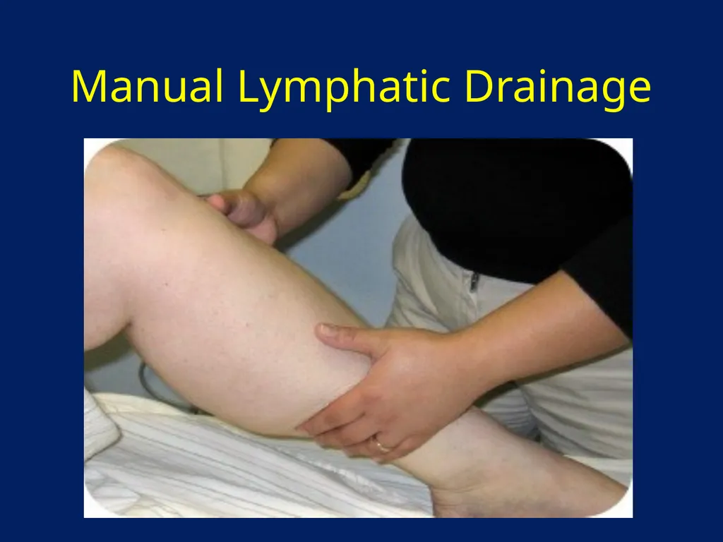 Lymphatic Disorders References Therapeutic - slide 23 of 44