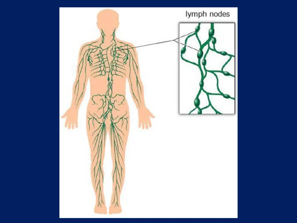 Lymphatic Disorders References Therapeutic - slide 4 of 44
