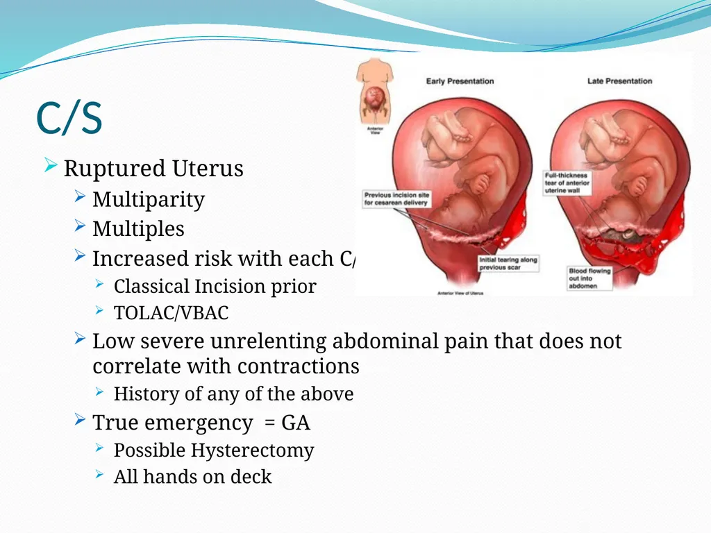 An Introduction to Obstetrical Emergencies Charles - slide 36 of 49