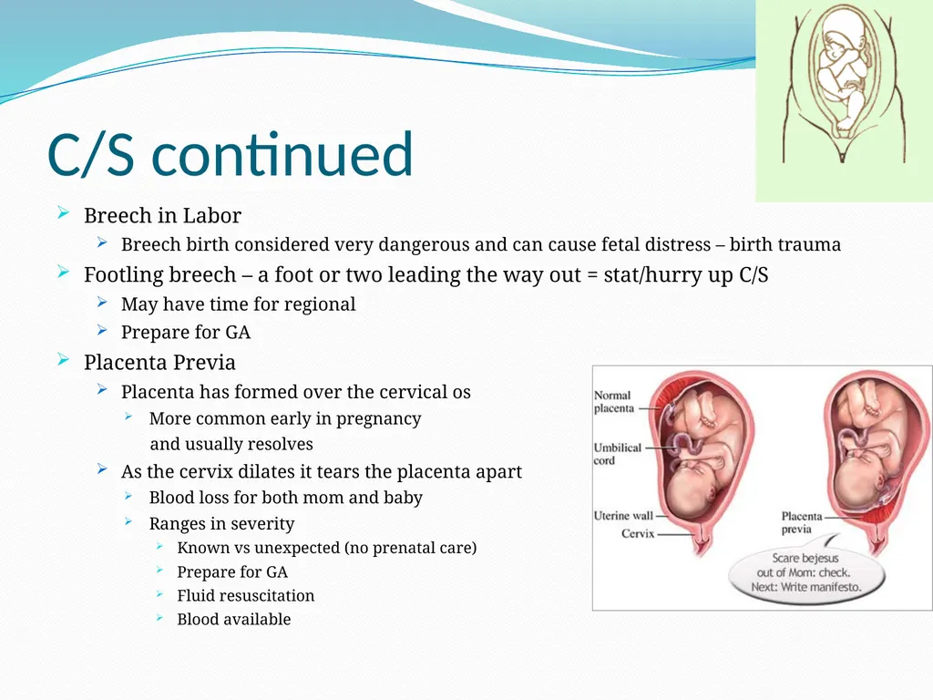 An Introduction to Obstetrical Emergencies Charles - slide 34 of 49
