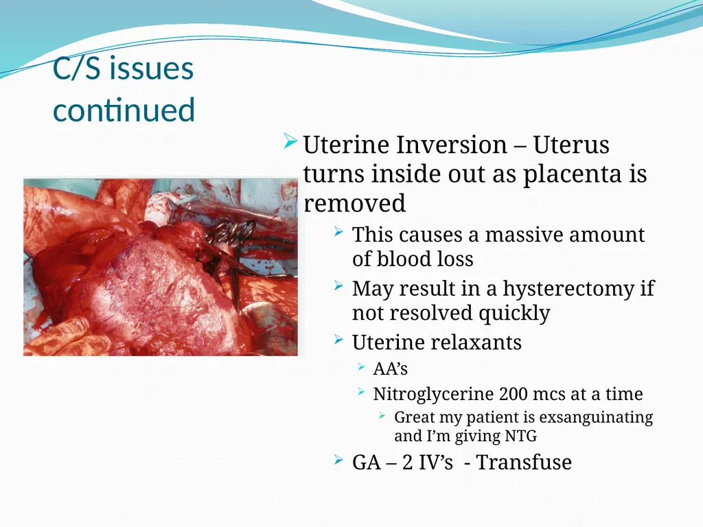 An Introduction to Obstetrical Emergencies Charles - slide 40 of 49