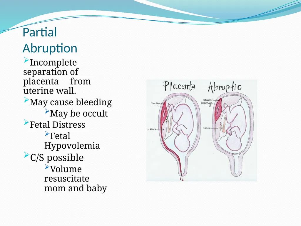 An Introduction to Obstetrical Emergencies Charles - slide 28 of 49