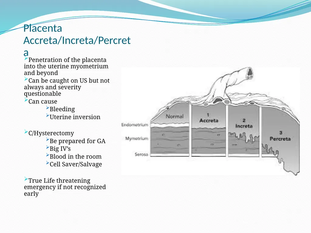 An Introduction to Obstetrical Emergencies Charles - slide 29 of 49