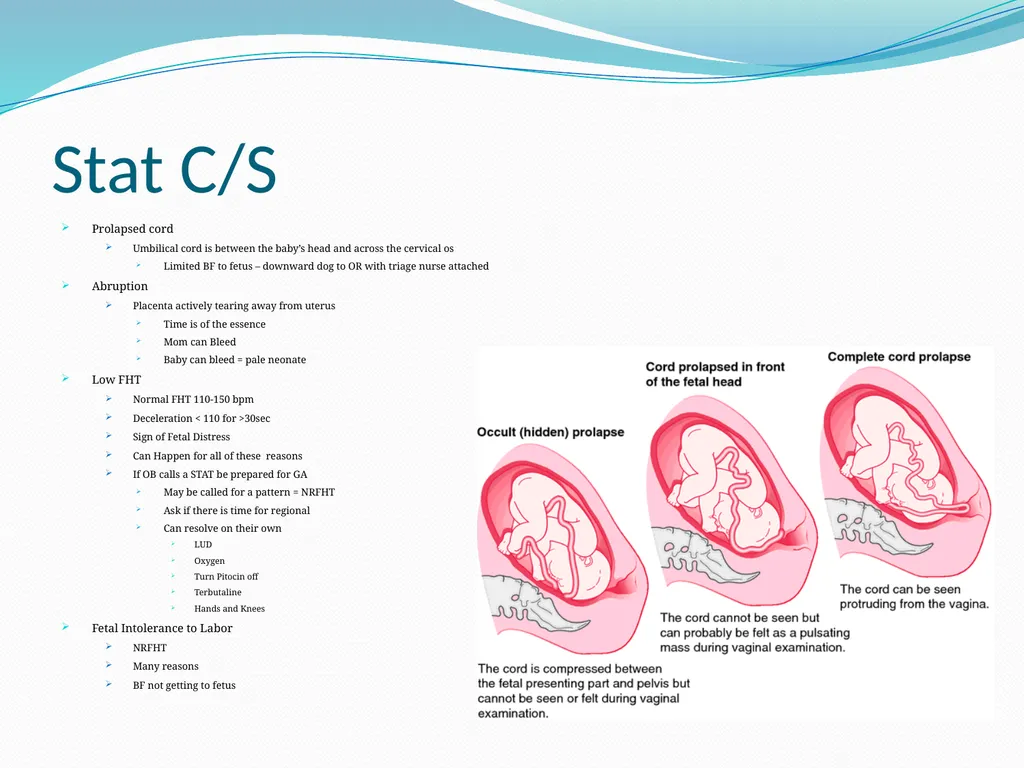 An Introduction to Obstetrical Emergencies Charles - slide 33 of 49