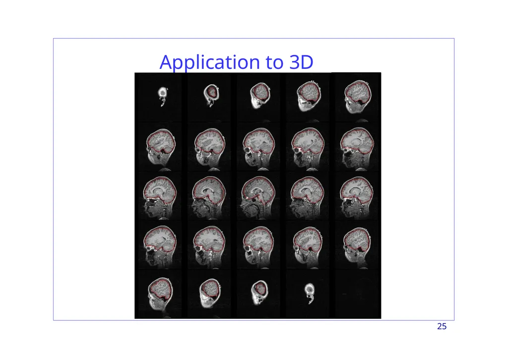 Region-based Segmentation Image Segmentation 2 - slide 25 of 41