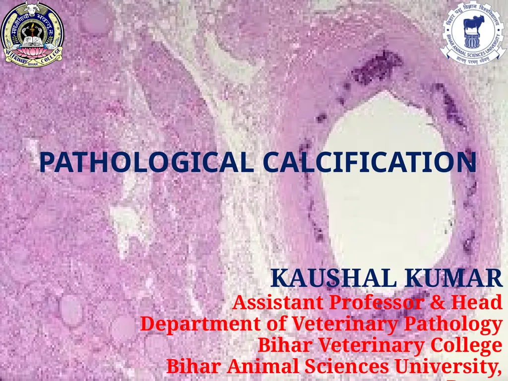 PATHOLOGICAL CALCIFICATION KAUSHAL KUMAR Assistant - slide 1 of 11