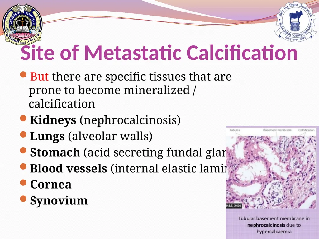 PATHOLOGICAL CALCIFICATION KAUSHAL KUMAR Assistant - slide 9 of 11