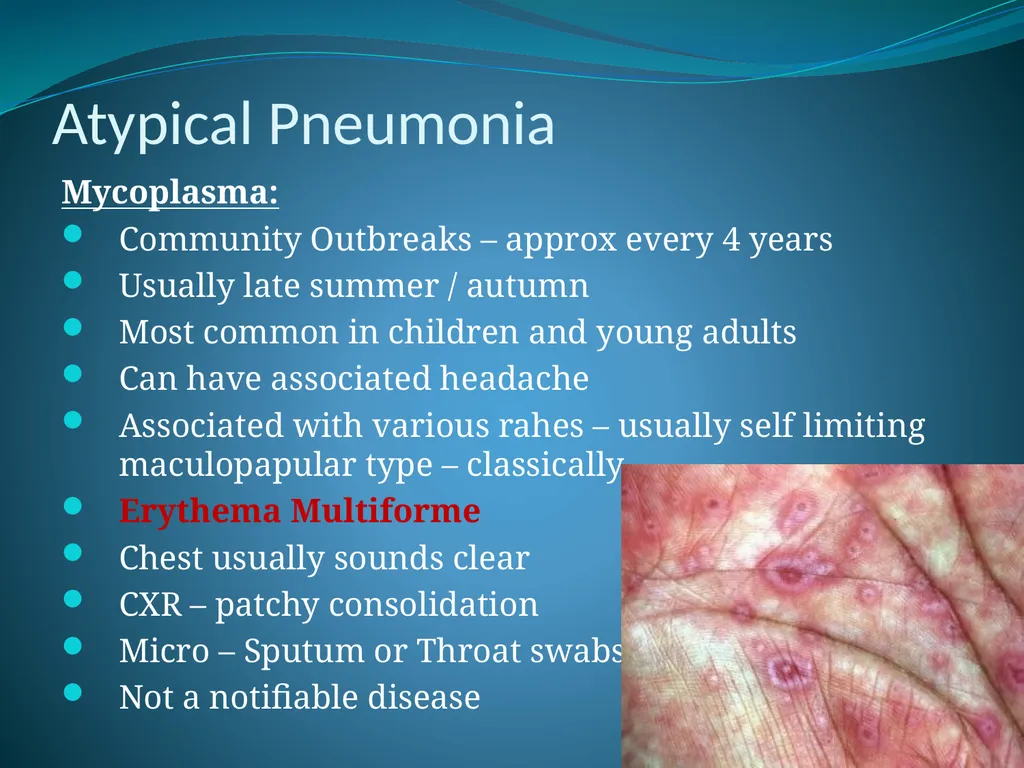 Respiratory Medicine in General Practice Dr Andrew - slide 36 of 140