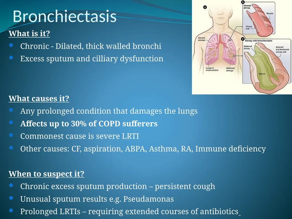 Respiratory Medicine in General Practice Dr Andrew - slide 126 of 140