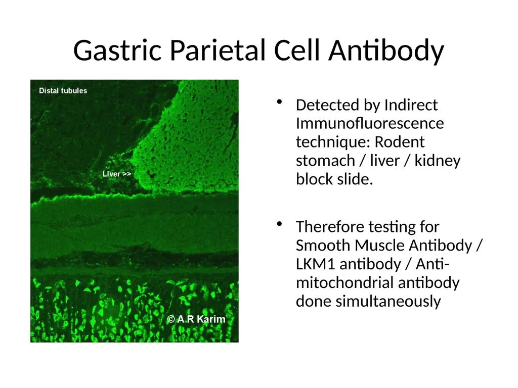 A quick guide to Immunology testing in Pernicious - slide 4 of 9