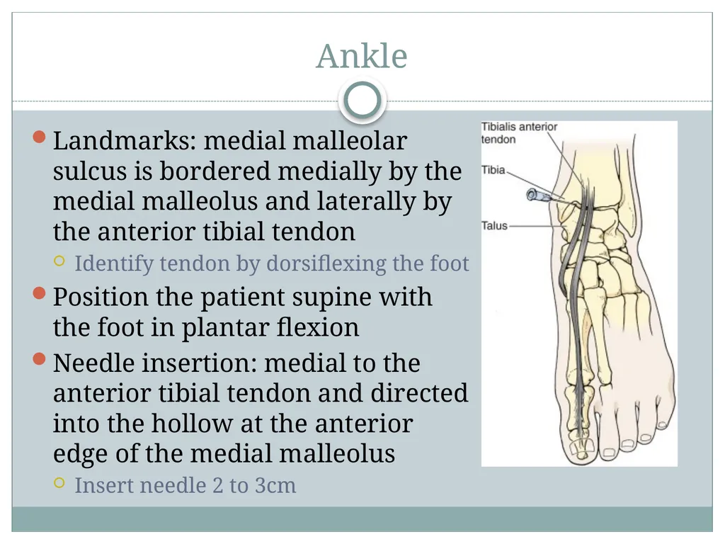 ORTHO CURRICULUM Procedures: Arthrocentesis - slide 11 of 12