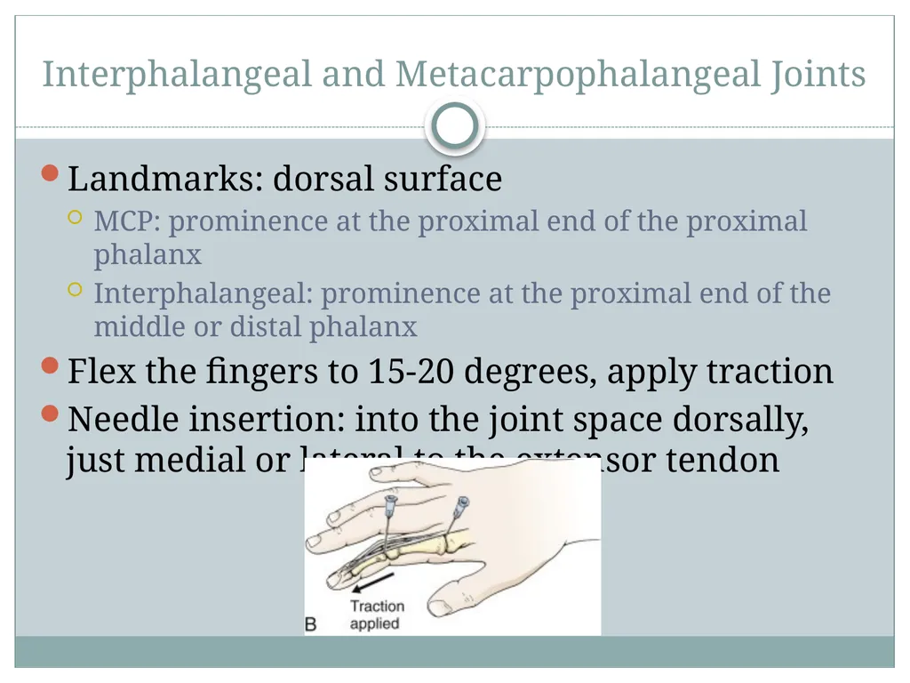 ORTHO CURRICULUM Procedures: Arthrocentesis - slide 6 of 12