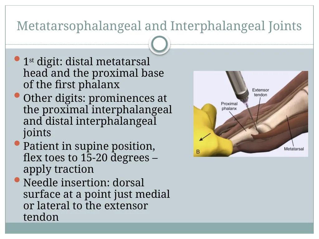 ORTHO CURRICULUM Procedures: Arthrocentesis - slide 12 of 12