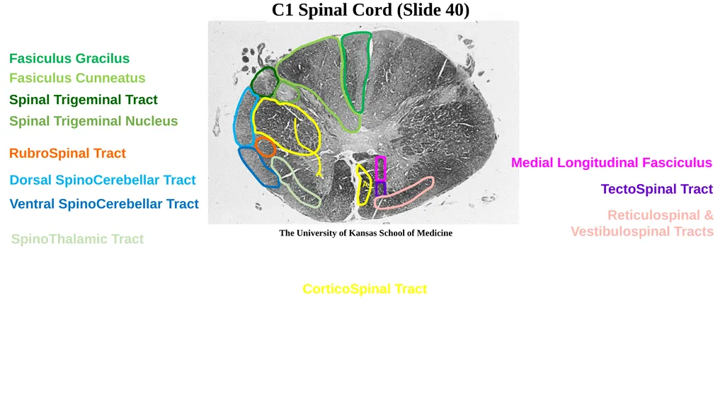 Neuroanatomy Brainstem Slides Self Assessment Use - slide 2 of 13