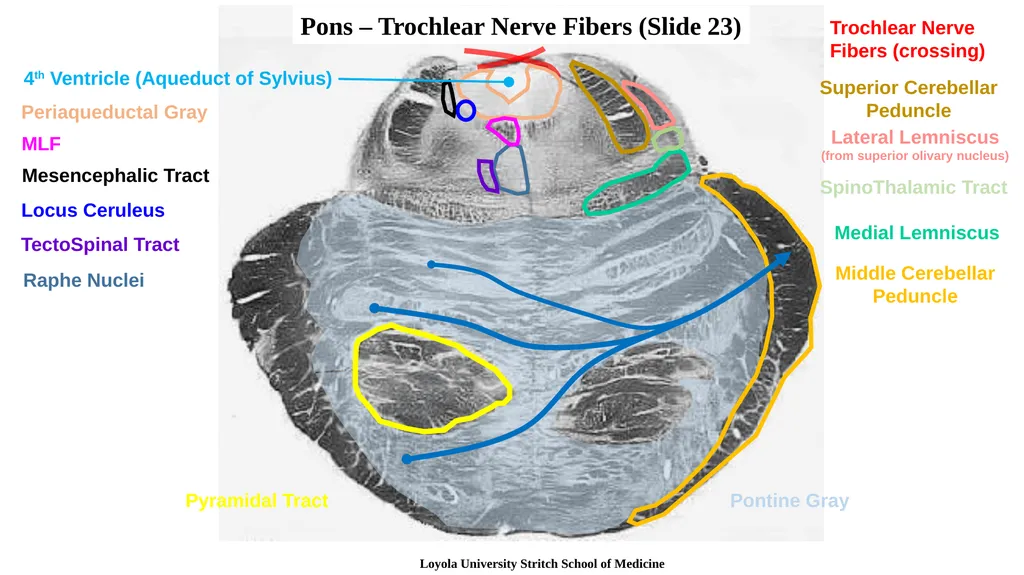 Neuroanatomy Brainstem Slides Self Assessment Use - slide 10 of 13