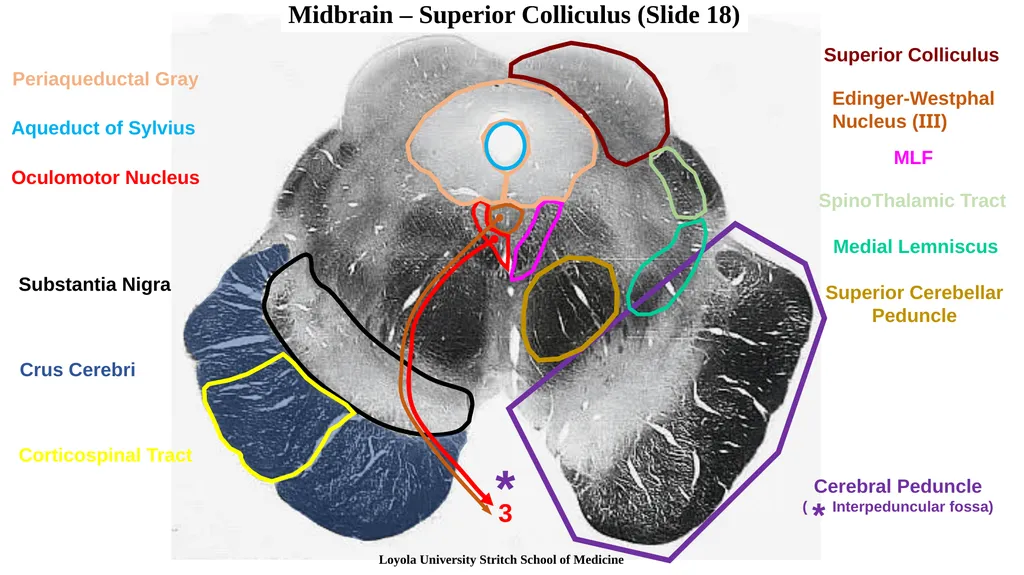 Neuroanatomy Brainstem Slides Self Assessment Use - slide 12 of 13