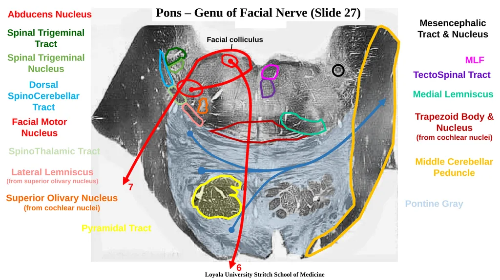 Neuroanatomy Brainstem Slides Self Assessment Use - slide 8 of 13