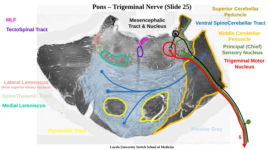 Neuroanatomy Brainstem Slides Self Assessment Use - slide 9 of 13