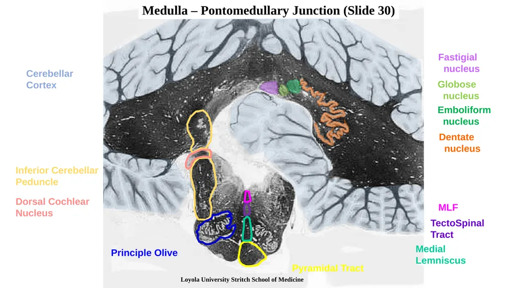 Neuroanatomy Brainstem Slides Self Assessment Use - slide 7 of 13