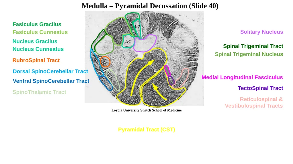 Neuroanatomy Brainstem Slides Self Assessment Use - slide 3 of 13