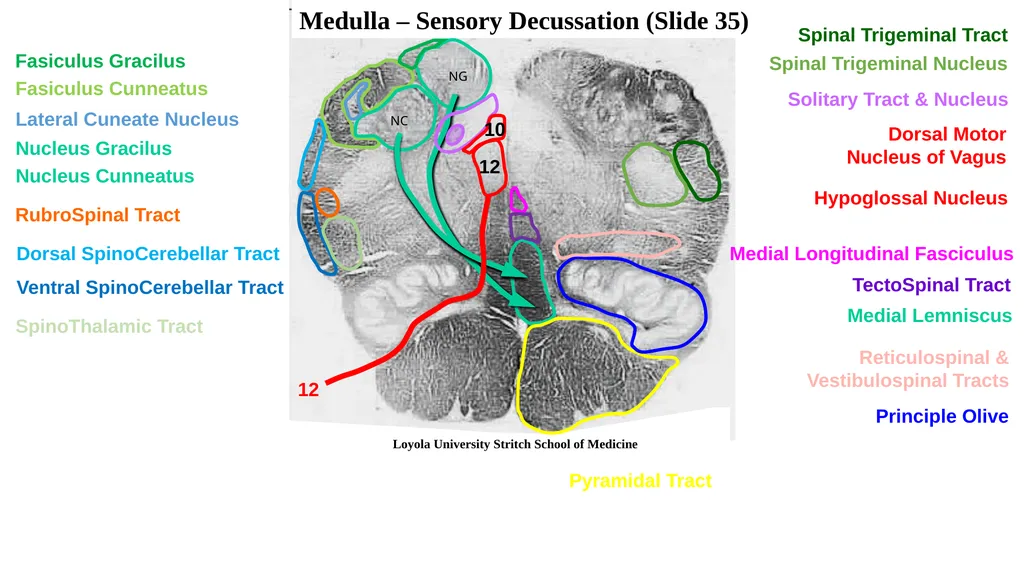 Neuroanatomy Brainstem Slides Self Assessment Use - slide 4 of 13