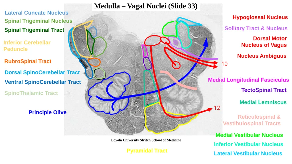 Neuroanatomy Brainstem Slides Self Assessment Use - slide 5 of 13