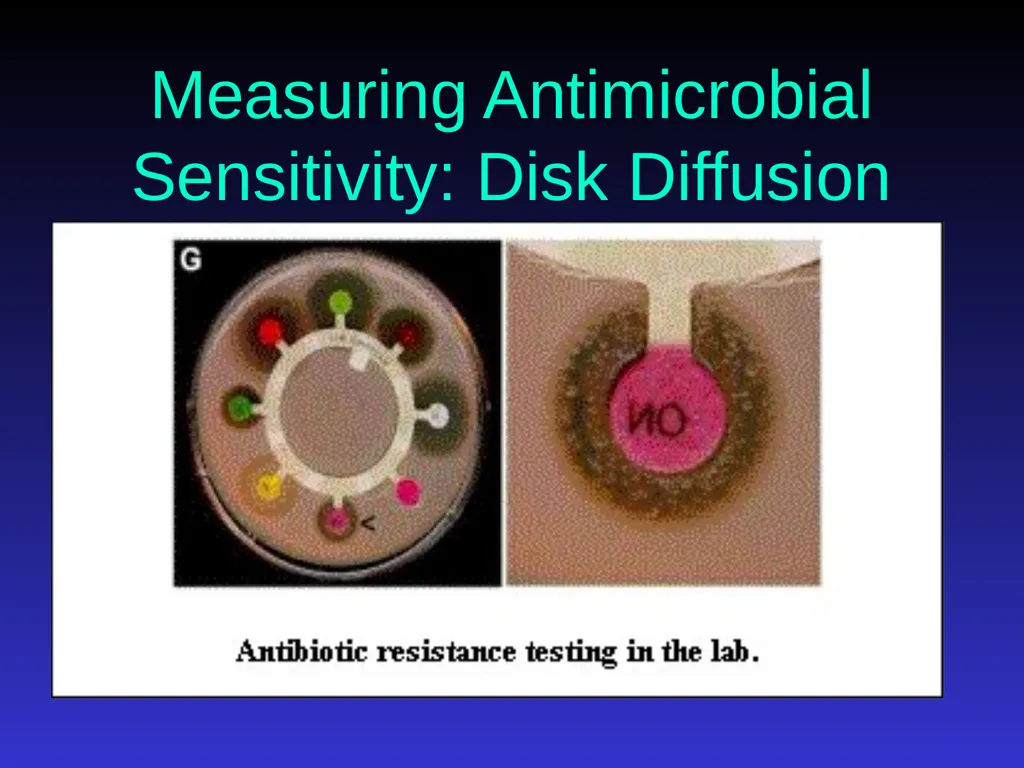 Application of Antibiotics Discs Assisst.Prof. - slide 26 of 33