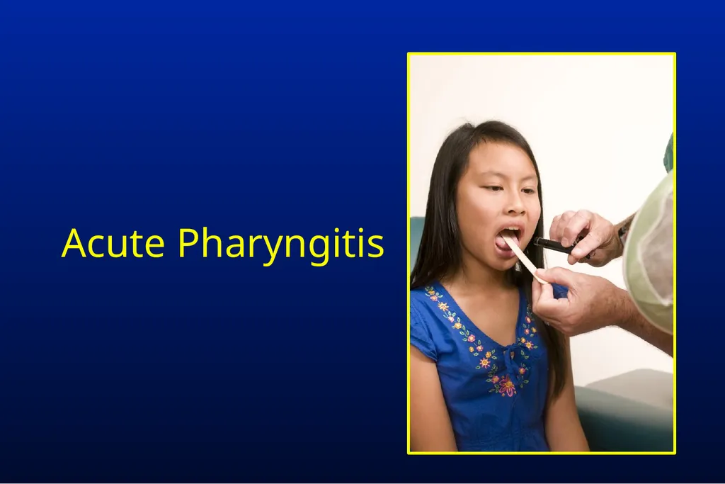 Common Respiratory Tract Infections: Evaluation - slide 30 of 44