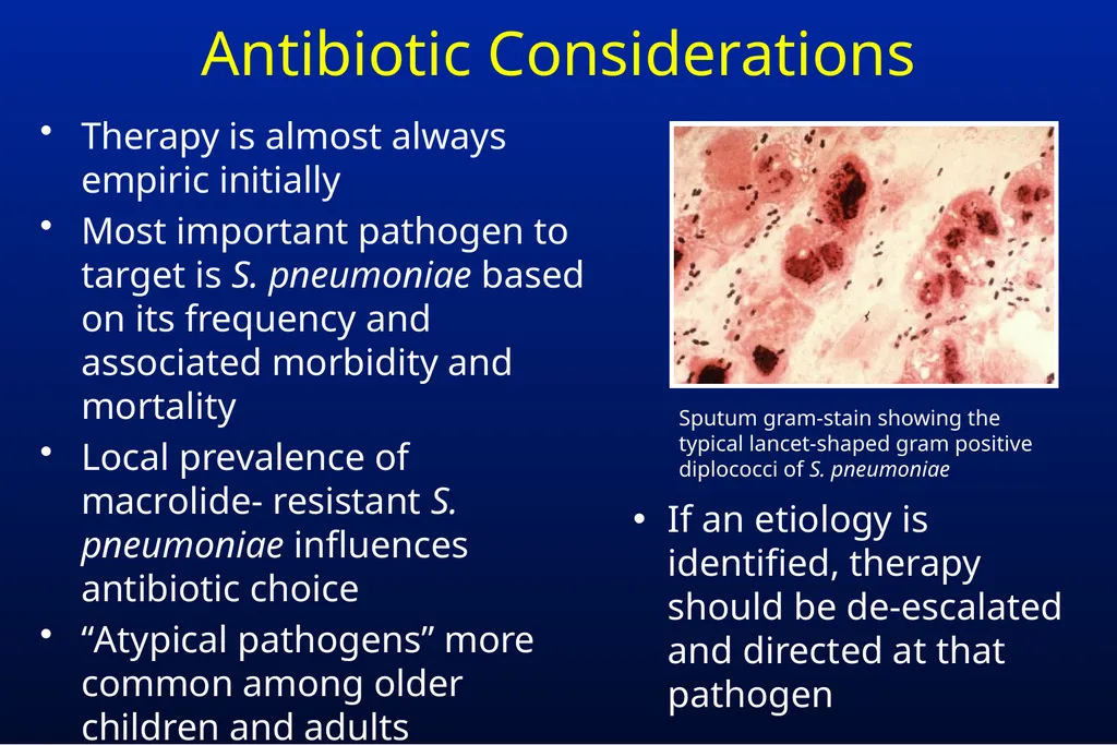 Common Respiratory Tract Infections: Evaluation - slide 17 of 44