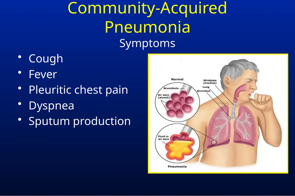 Common Respiratory Tract Infections: Evaluation - slide 14 of 44