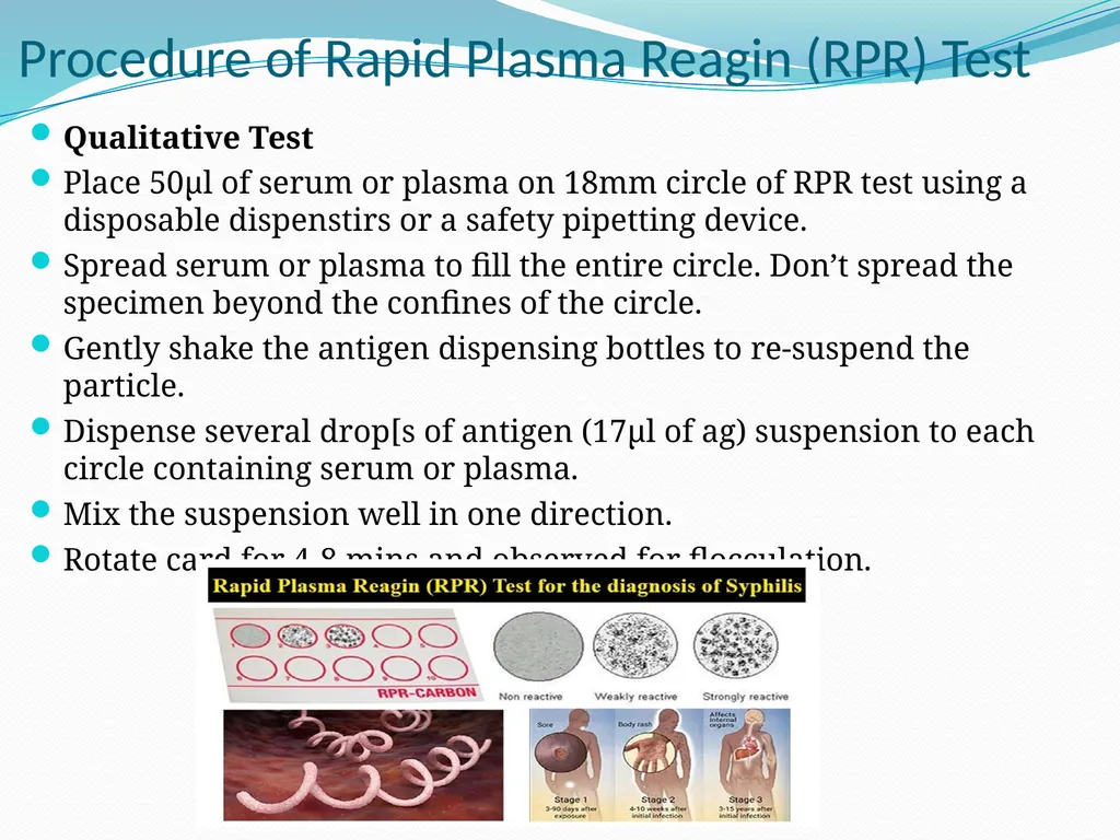 Serological tests Assis .Lec. Dhuha khudaier - slide 16 of 24