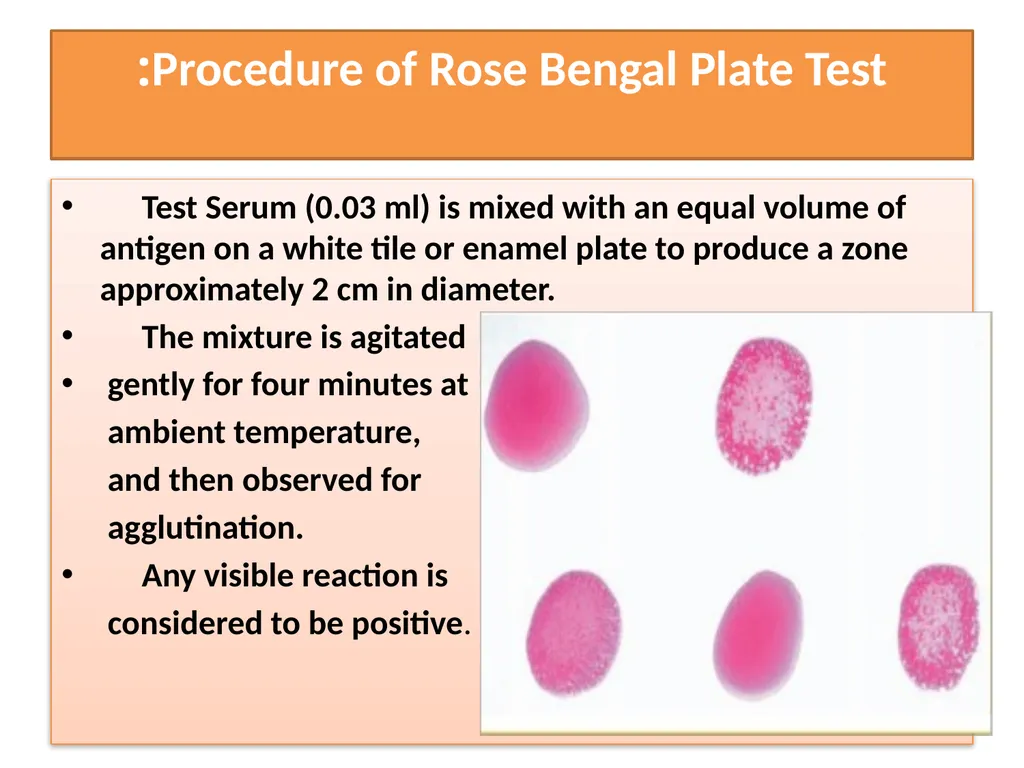 Serological tests A serology blood test is - slide 4 of 18