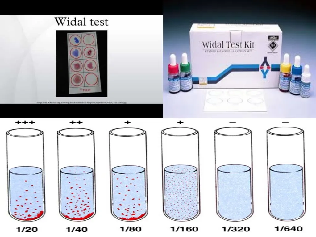 Serological tests A serology blood test is - slide 8 of 18