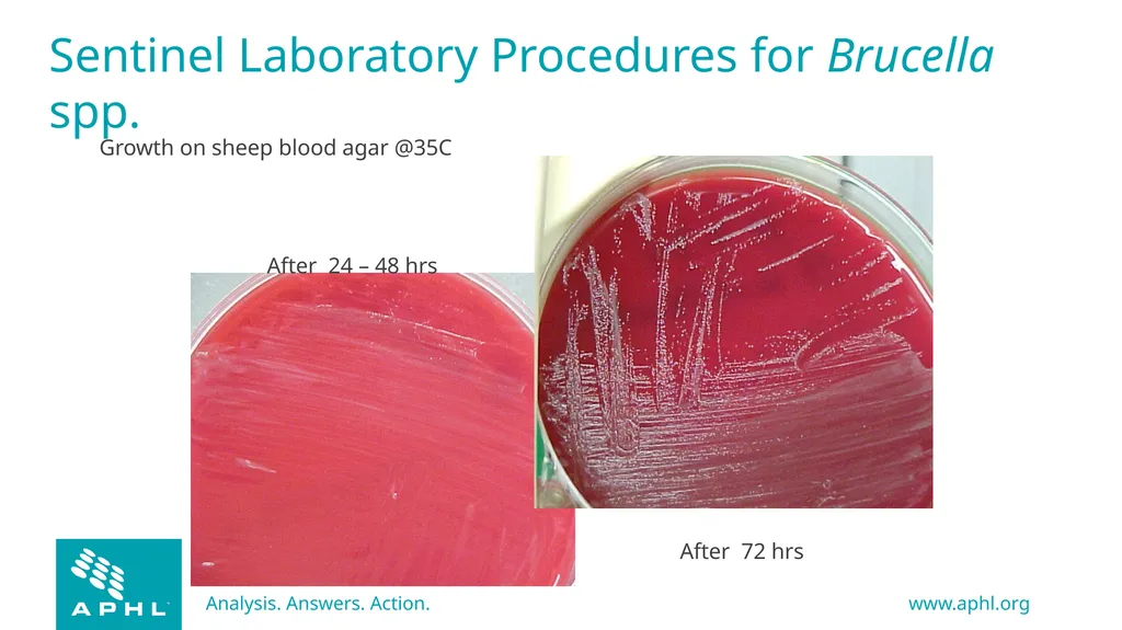 Agents of Bioterrorism Brucella species: - slide 12 of 21