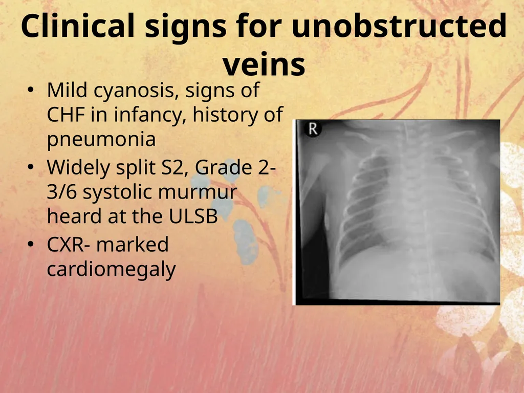 Cyanotic congenital heart disease BY MBBSPPT.COM - slide 36 of 41