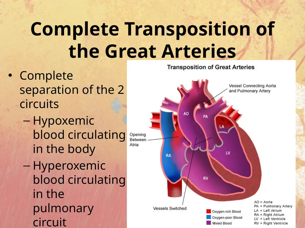 Cyanotic congenital heart disease BY MBBSPPT.COM - slide 29 of 41