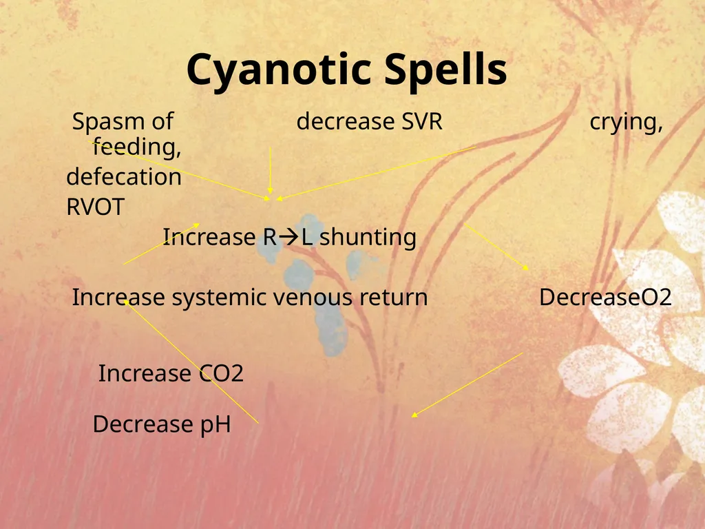 Cyanotic congenital heart disease BY MBBSPPT.COM - slide 19 of 41