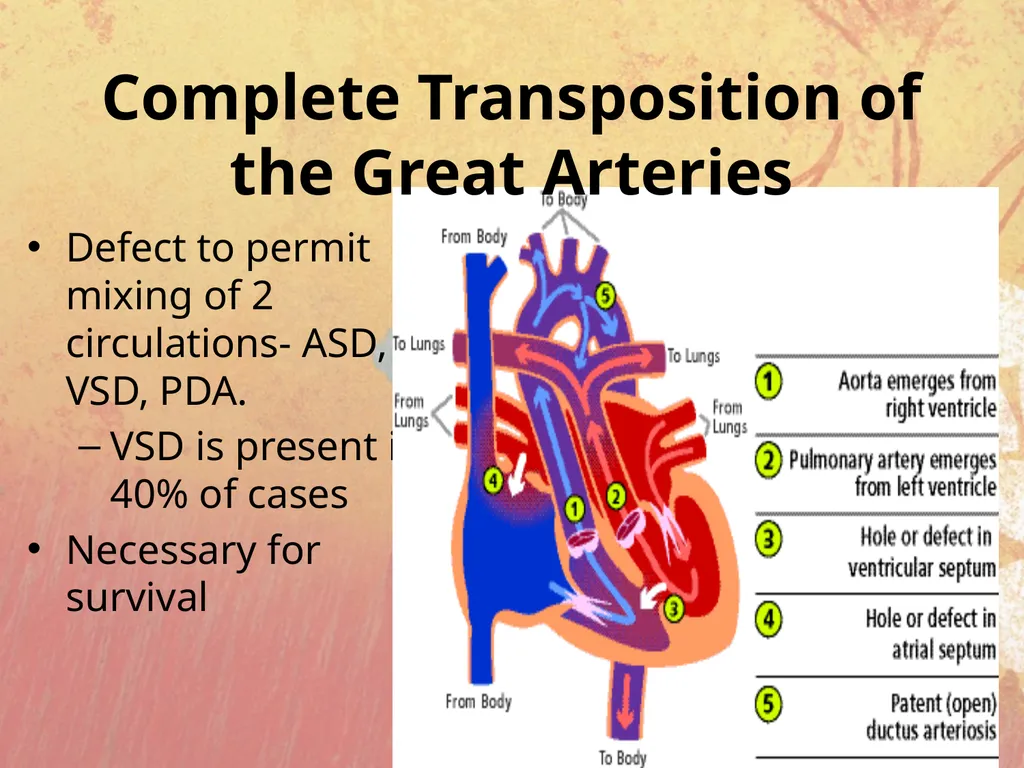Cyanotic congenital heart disease BY MBBSPPT.COM - slide 30 of 41