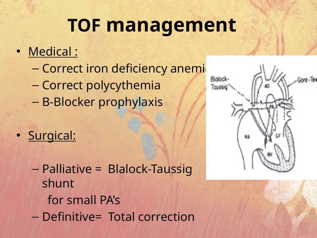Cyanotic congenital heart disease BY MBBSPPT.COM - slide 21 of 41