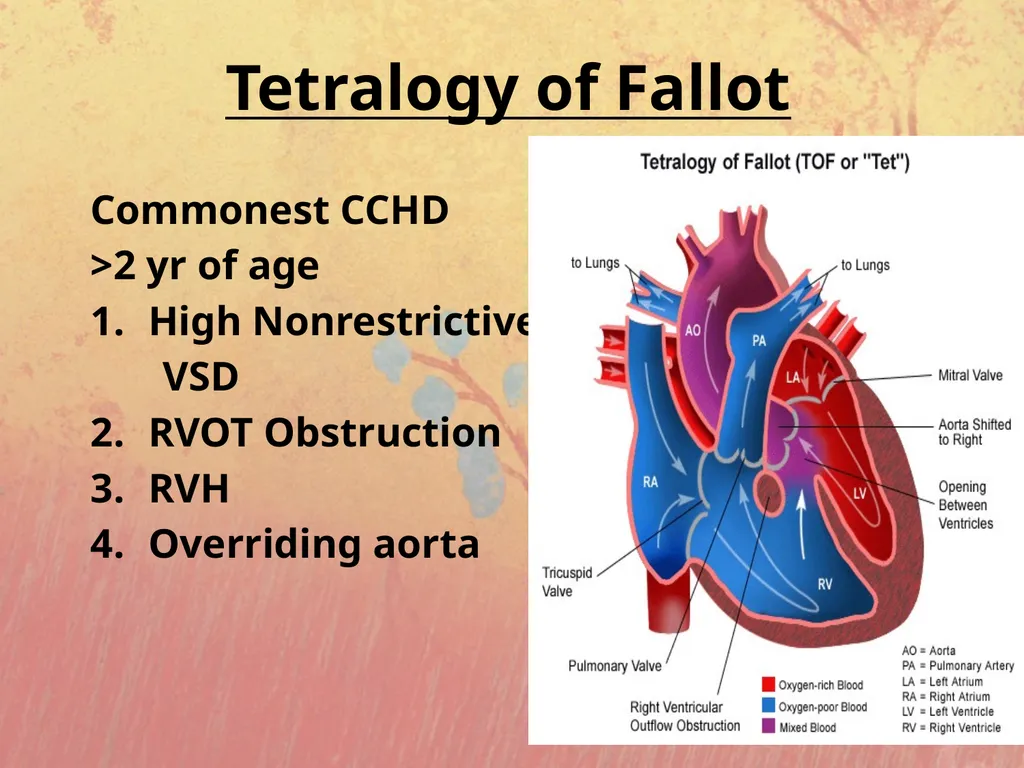 Cyanotic congenital heart disease BY MBBSPPT.COM - slide 8 of 41