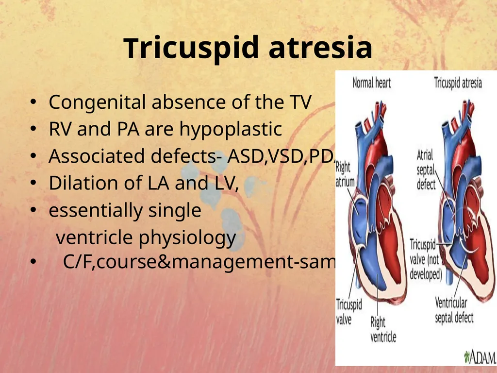 Cyanotic congenital heart disease BY MBBSPPT.COM - slide 23 of 41