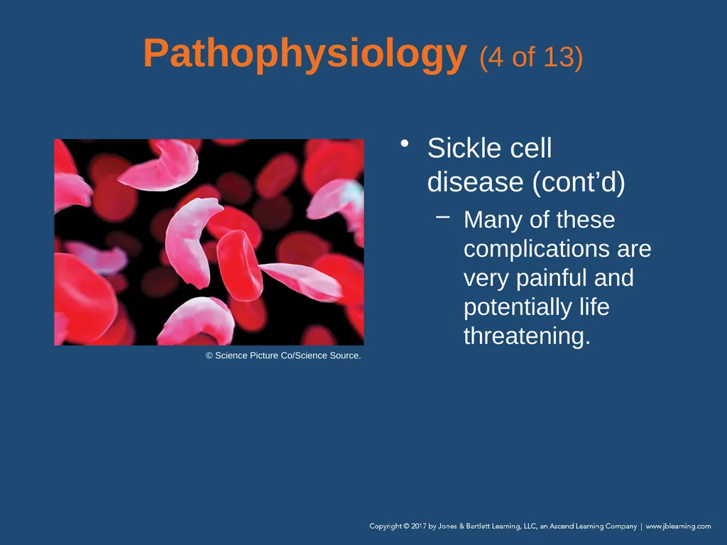 Chapter 19 Endocrine and Hematologic Emergencies - slide 62 of 140