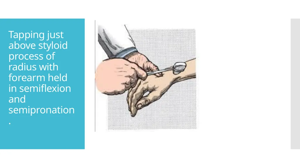 EXAMINATION OF UPPER LIMB DEEP TENDON REFLEXES Dr - slide 16 of 28
