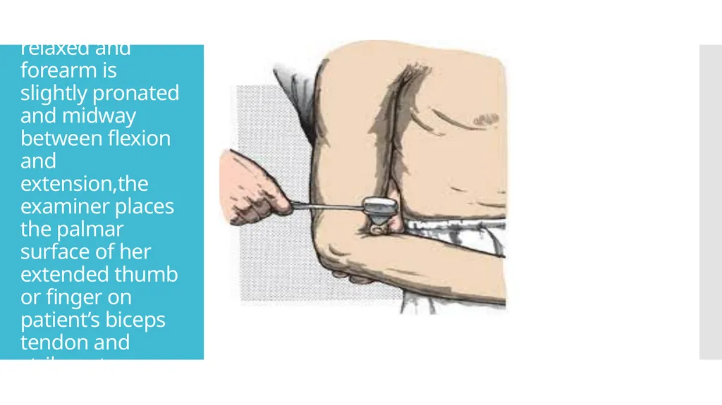 EXAMINATION OF UPPER LIMB DEEP TENDON REFLEXES Dr - slide 12 of 28