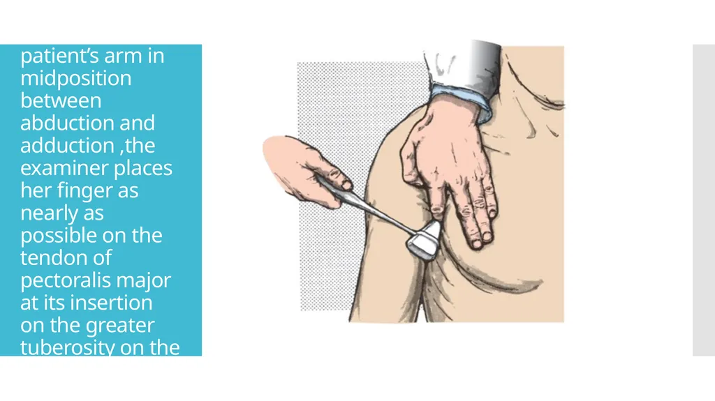 EXAMINATION OF UPPER LIMB DEEP TENDON REFLEXES Dr - slide 21 of 28