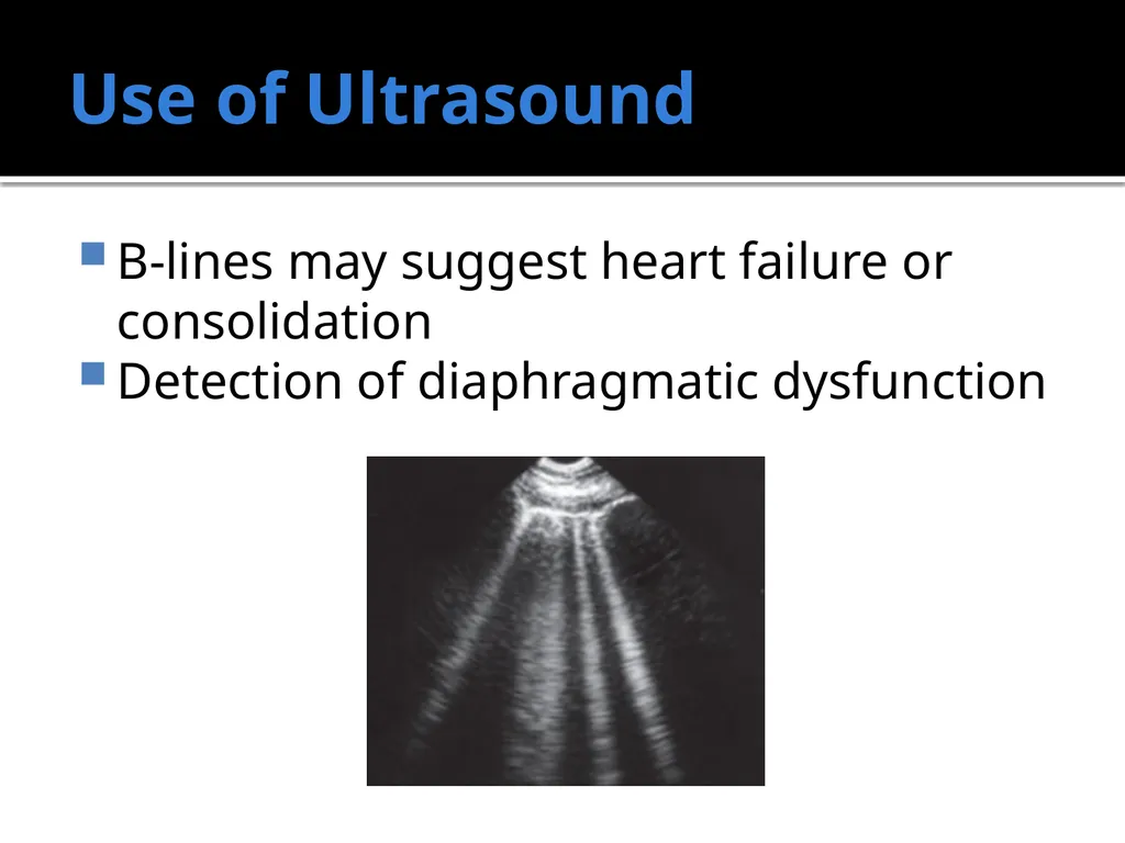 Weaning from the Ventilator Saadiq Moolla ICU - slide 14 of 28